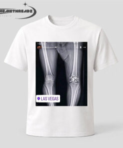 Conor McGregor X-ray Broken Knee knee Shirt